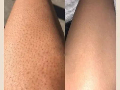 Résultat cliente Lolyshine