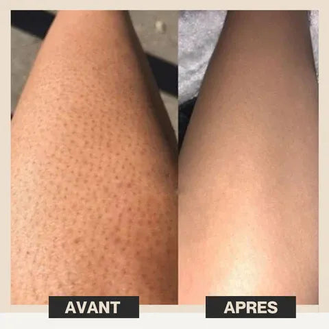 Lolyshine Gomme Dépilatoire Réutilisable